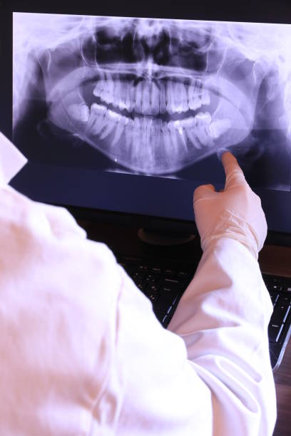 Best Emergency Dental Care for Sports Injuries in Woodbury Center, CT